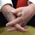 Je v poriadku Trumpove modriny na rukach vyvolavaju obavy