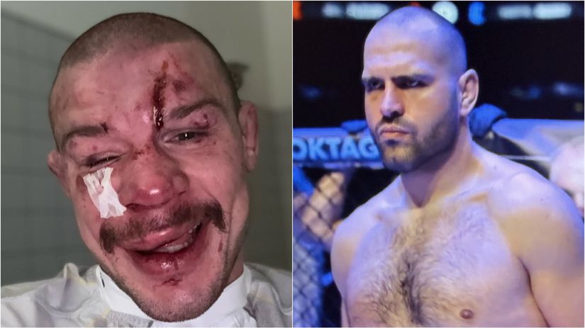 Krvavy prazsky kupel pre Slovakov Princ bratislavsky schytal vyprask necakany knokaut pre Budaya