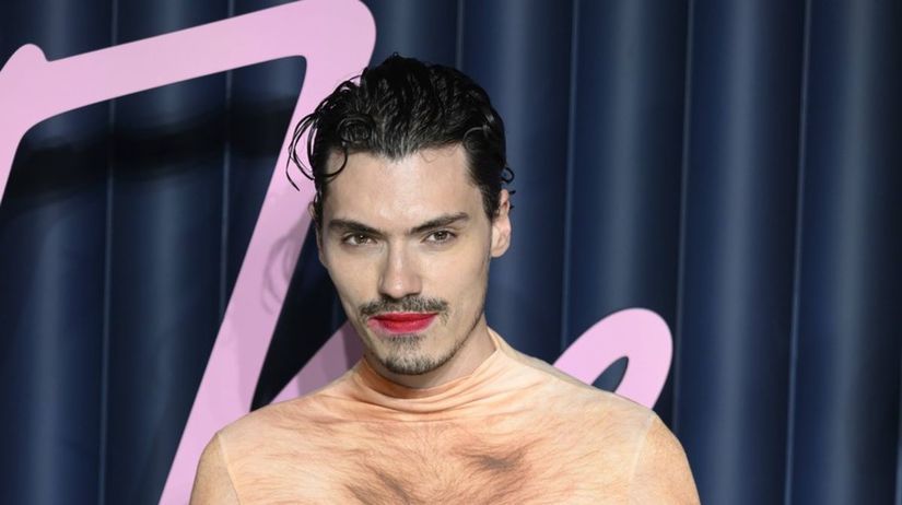 Mysli to vazne Influencer sokoval odhalenym rozkrokom