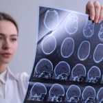 Zapal mozgu je minulostou Tuto jednoduchu no prelomovu metodu pozna len malokto