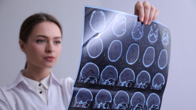 Zapal mozgu je minulostou Tuto jednoduchu no prelomovu metodu pozna len malokto