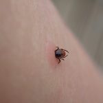 Nebezpecny moze byt aj bezny obed Uhryznutie kliestom moze sposobit smrtelnu alergiu na maso
