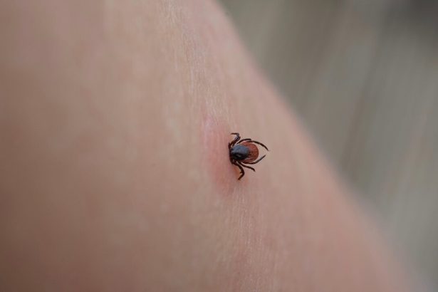 Nebezpecny moze byt aj bezny obed Uhryznutie kliestom moze sposobit smrtelnu alergiu na maso